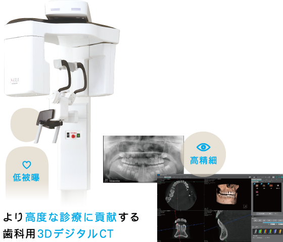 より高度な診療に貢献する歯科用3DデジタルCT