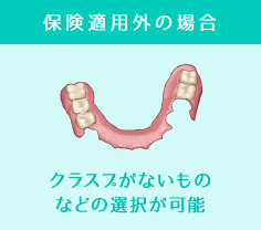 保険適用外の場合クラスプがないものなどの選択が可能