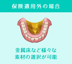 金属床など様々な素材の選択が可能